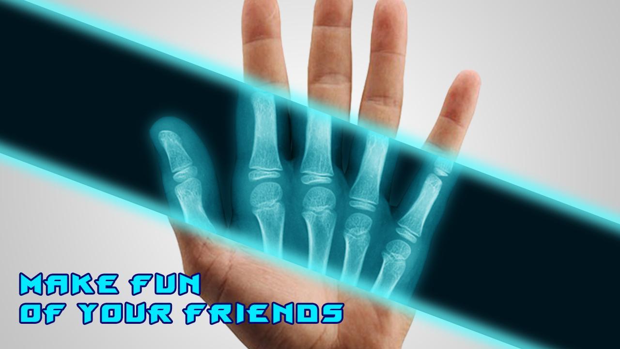 Best X-Ray FREE