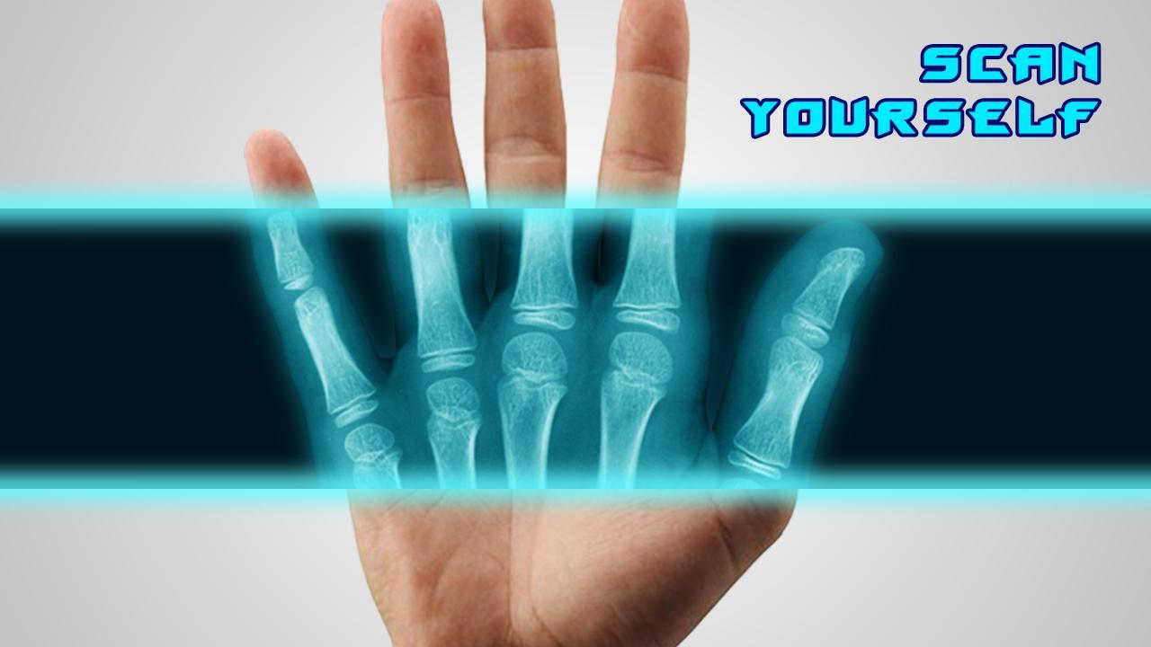 Best X-Ray FREE