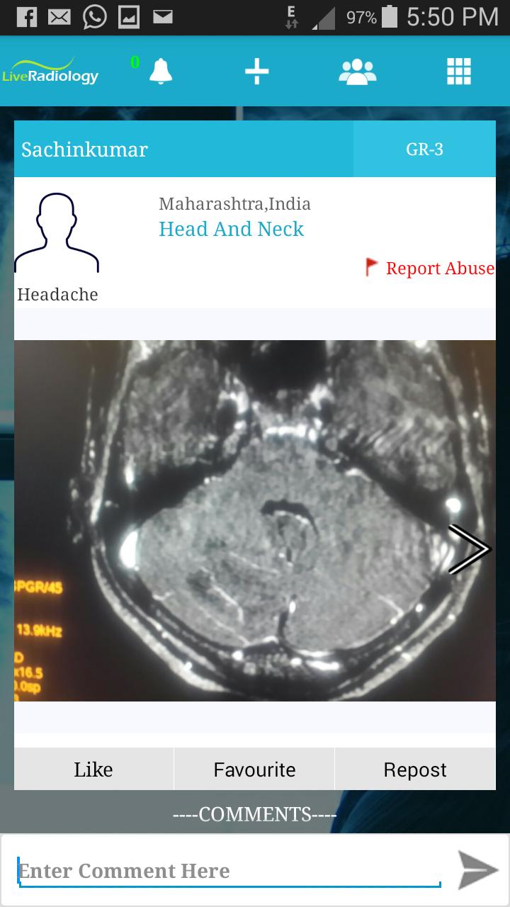 Live Radiology