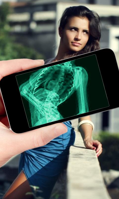 X-Ray Simulator : Prank